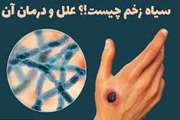  بیماری سیاه زخم (شاربن) را جدی بگیرید
